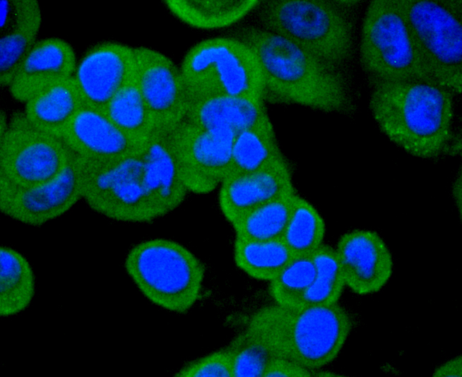 CD10 Rabbit mAb