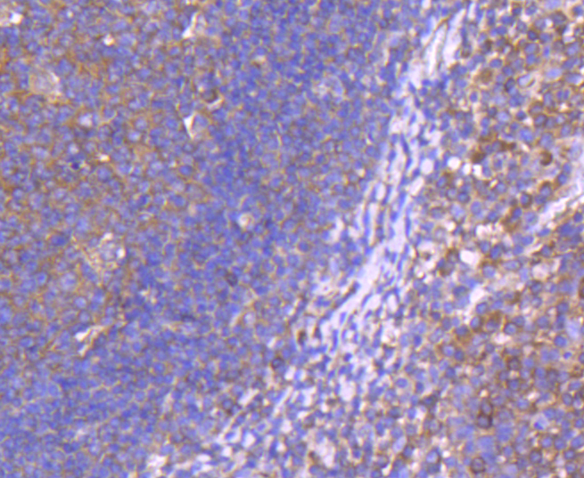 CD10 Rabbit mAb