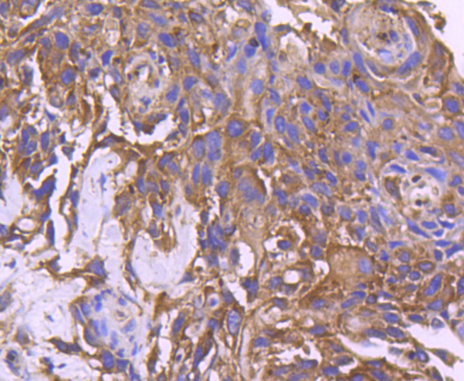 CD10 Rabbit mAb