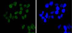 BRG1 Rabbit mAb