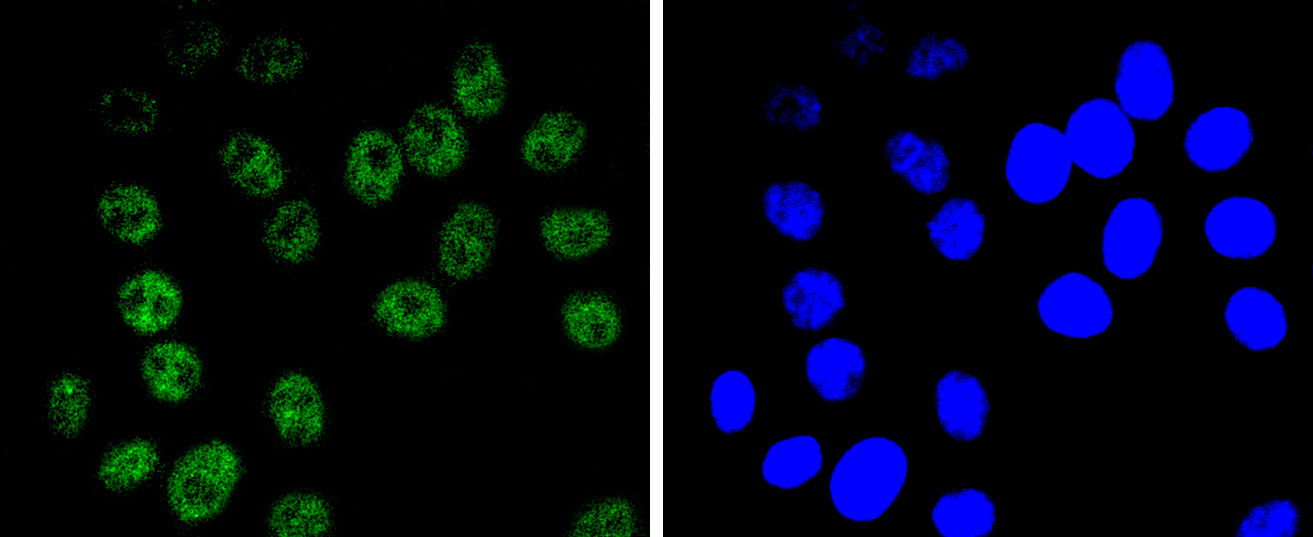 BRG1 Rabbit mAb