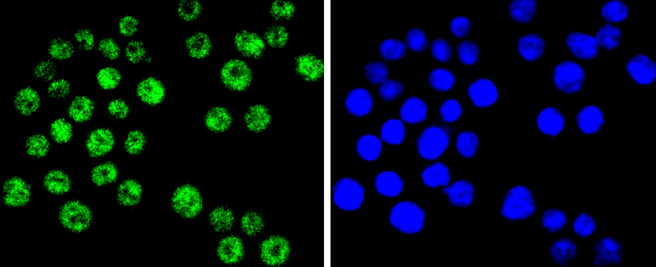 BRG1 Rabbit mAb