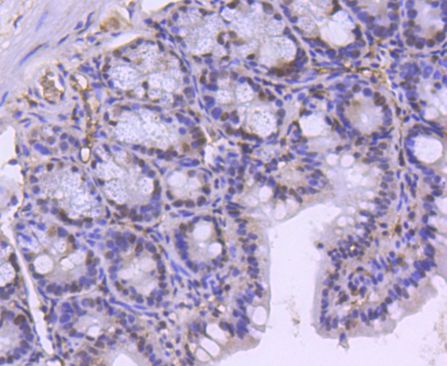 BRG1 Rabbit mAb