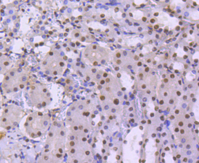 BRG1 Rabbit mAb