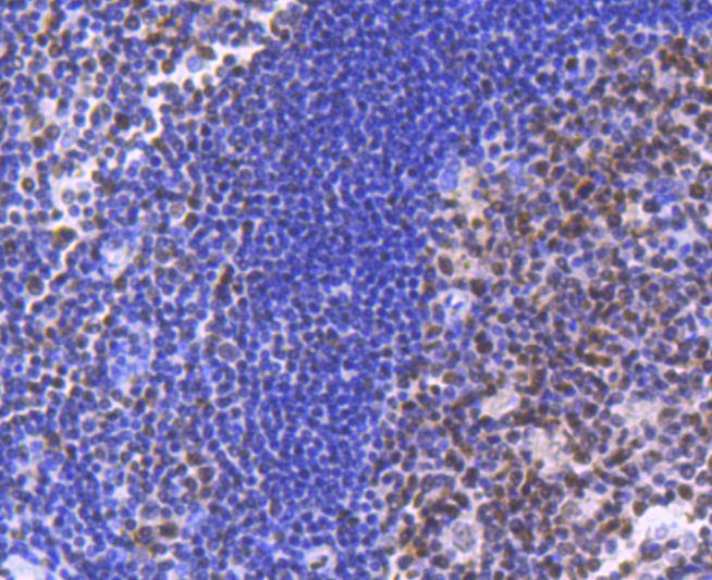 BRG1 Rabbit mAb