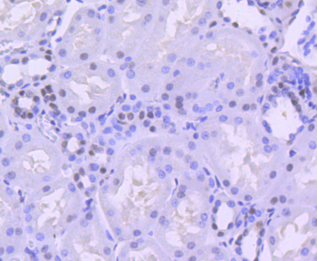 BRG1 Rabbit mAb