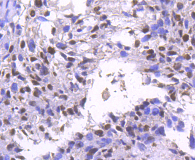 BRG1 Rabbit mAb