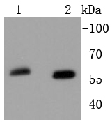 SOX10 Rabbit mAb