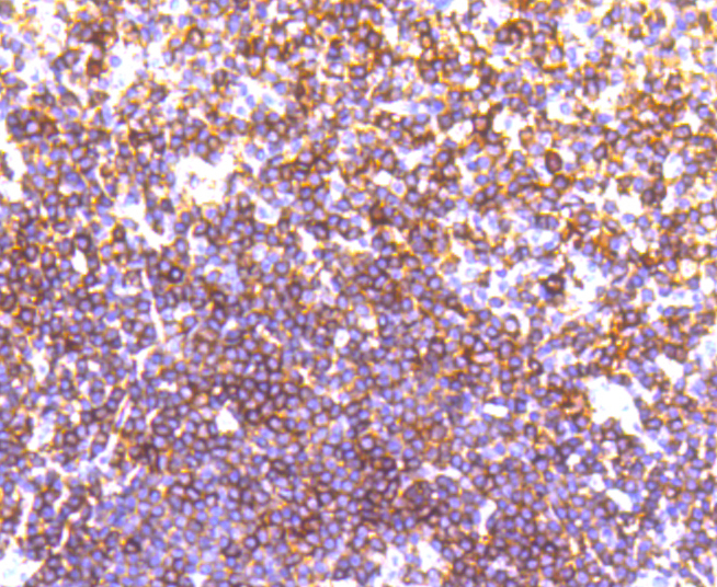 LSP1 Rabbit mAb