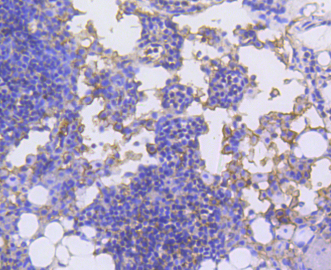 LSP1 Rabbit mAb