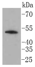 LSP1 Rabbit mAb