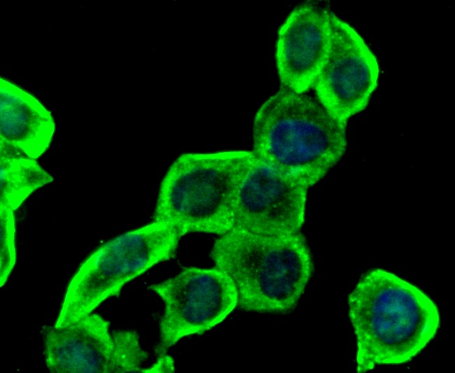 Insulin Receptor Beta Rabbit mAb