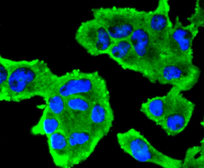 Insulin Receptor Beta Rabbit mAb