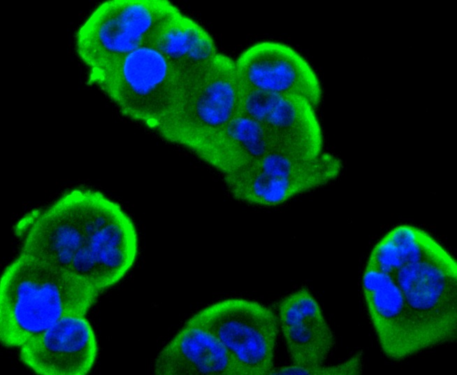 Insulin Receptor Beta Rabbit mAb