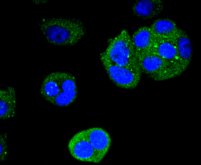 Cytokeratin 4 Rabbit mAb