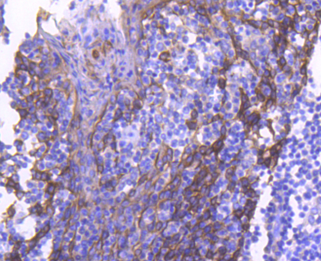 Cytokeratin 4 Rabbit mAb