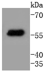 Cytokeratin 4 Rabbit mAb