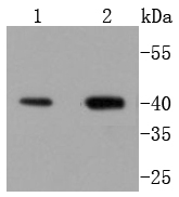 Delta Opioid Receptor Rabbit mAb