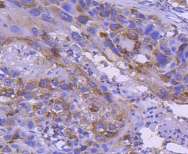 IRF5 Rabbit mAb