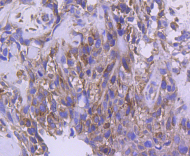 IRF5 Rabbit mAb