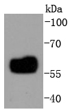 IRF5 Rabbit mAb