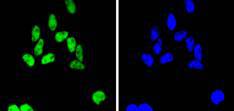 SMC1 Rabbit mAb