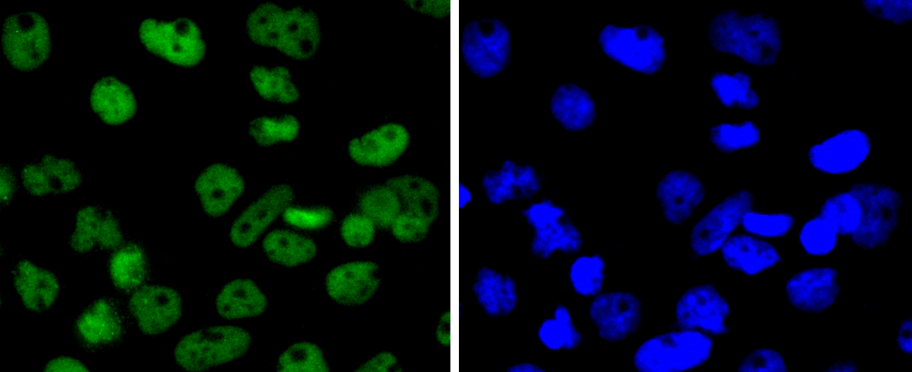 SMC1 Rabbit mAb