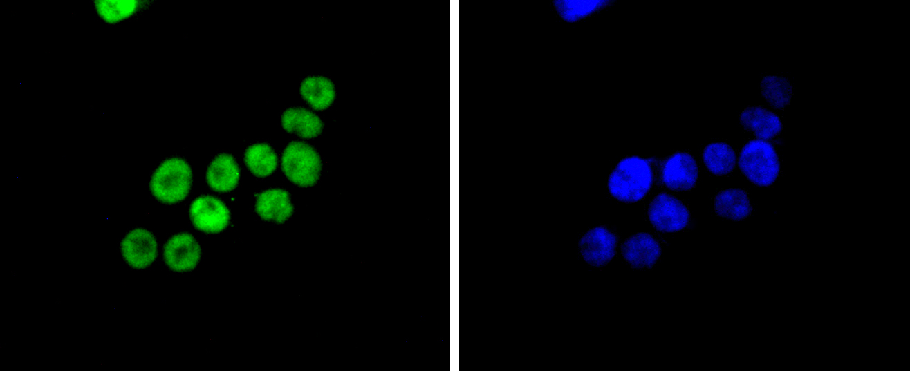 SMC1 Rabbit mAb