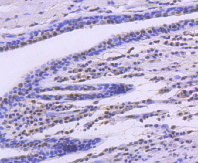 SMC1 Rabbit mAb