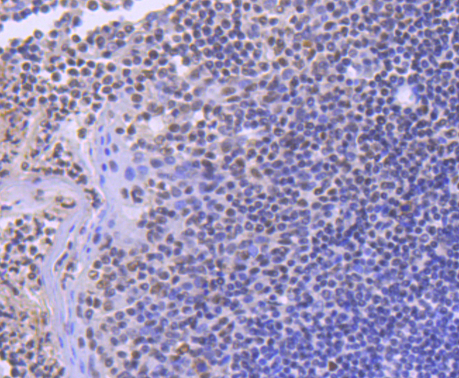 SMC1 Rabbit mAb