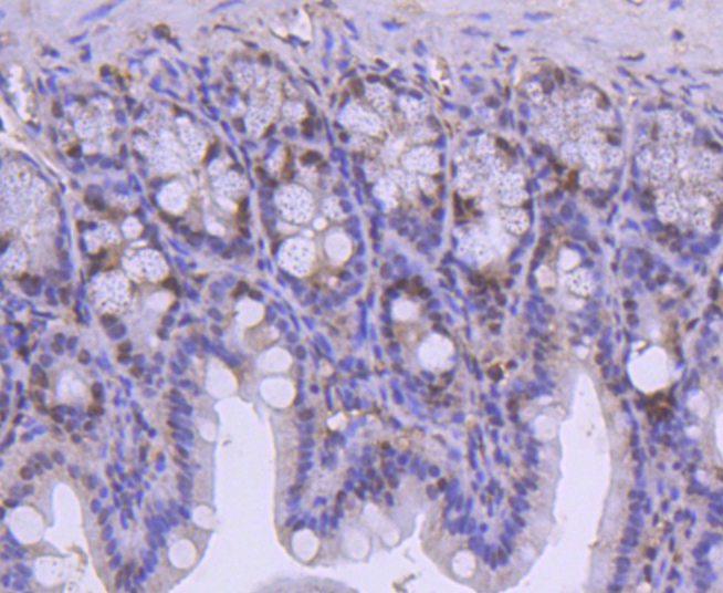 SMC1 Rabbit mAb