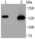 SMC1 Rabbit mAb