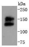 Ret Rabbit mAb