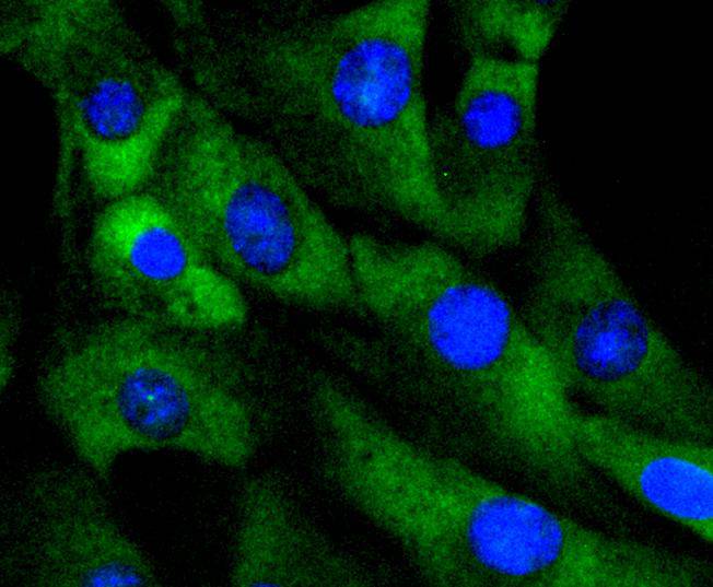 Cdk4 Rabbit mAb