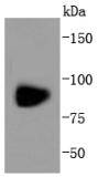 Glutamate receptor 1 Rabbit mAb