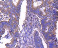 ARF1 Rabbit mAb