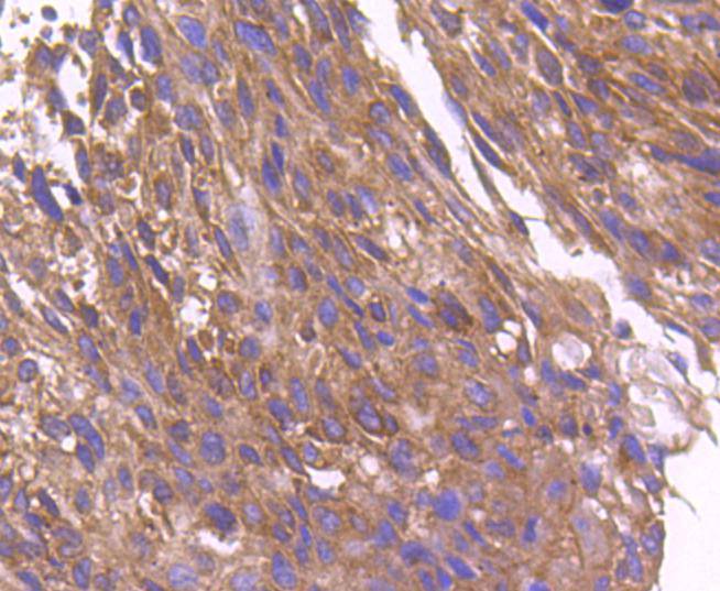 ARF1 Rabbit mAb