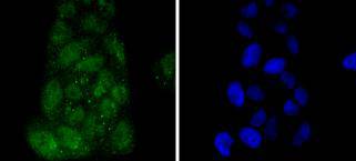 IRF3 Rabbit mAb