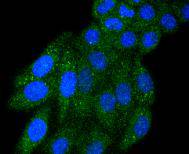 IRF5 Rabbit mAb