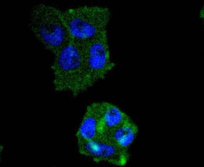 IRF5 Rabbit mAb