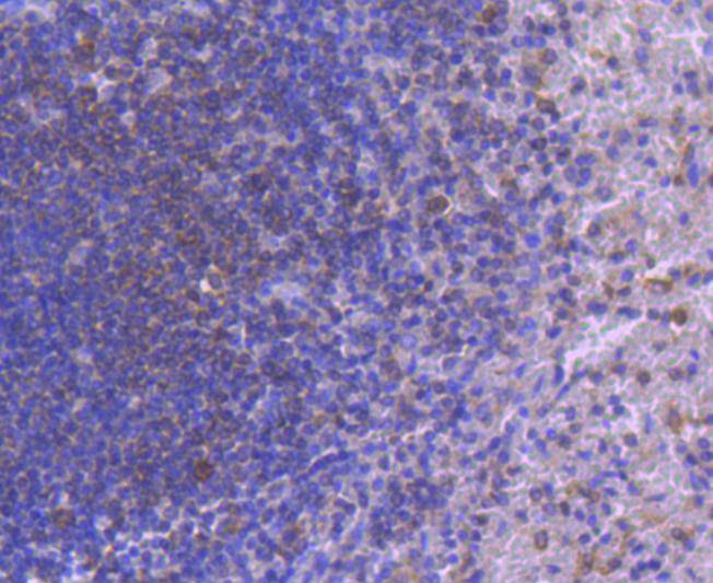 IRF5 Rabbit mAb