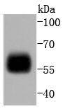 IRF5 Rabbit mAb