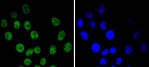 Cyclin E1 Rabbit mAb