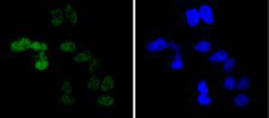 Cyclin E1 Rabbit mAb