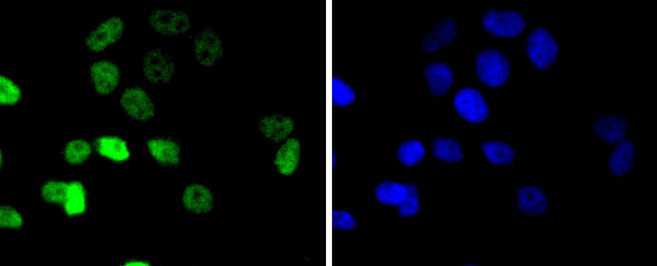 Cyclin E1 Rabbit mAb