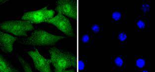 Cyclin E2 Rabbit mAb