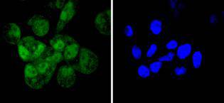 Cyclin E2 Rabbit mAb