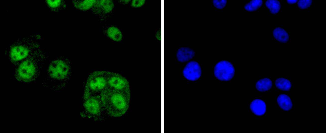 Cyclin E2 Rabbit mAb