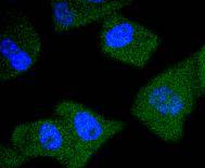 Prostate Specific Antigen Rabbit mAb