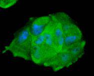 STAT1 alpha Rabbit mAb